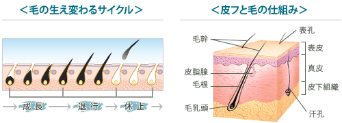 痛みが少ない脱毛 エステのエルセーヌ